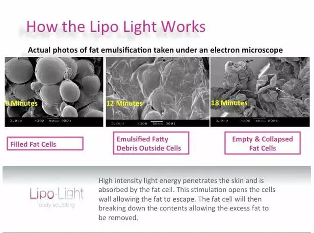 ABQ Lipo Light