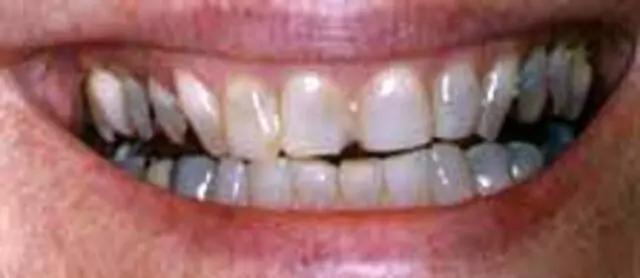ABQ Dental Associates