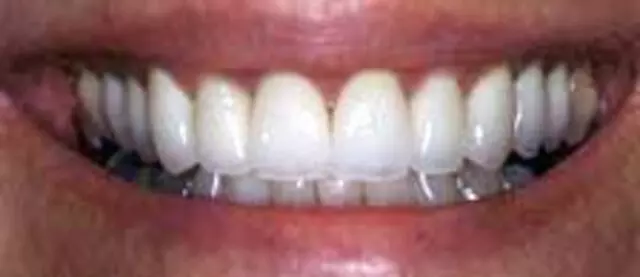 ABQ Dental Associates